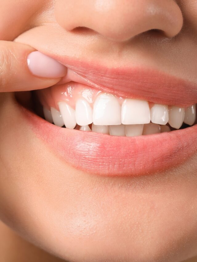Why your gums are receding – And what to do about it4 hours ago