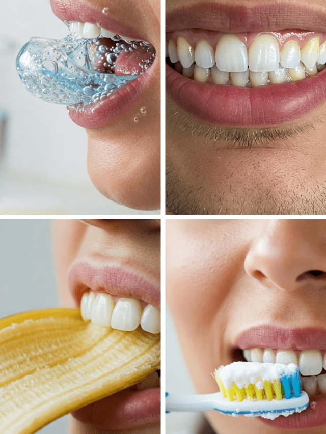 Whiten Your Teeth Naturally At Home: 7 Simple Hacks