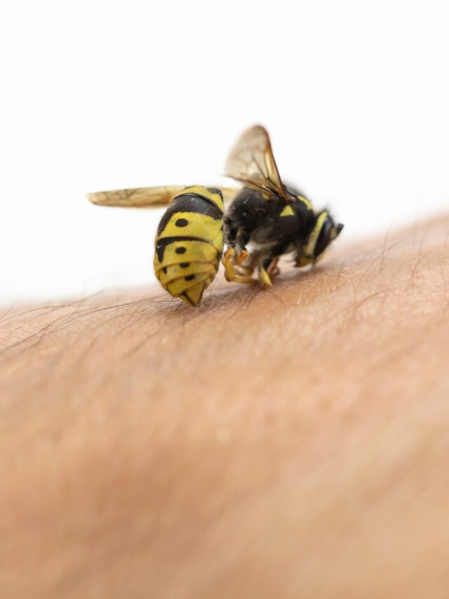 Bee stings explained: Symptoms, risks, and quick action7 hours ago