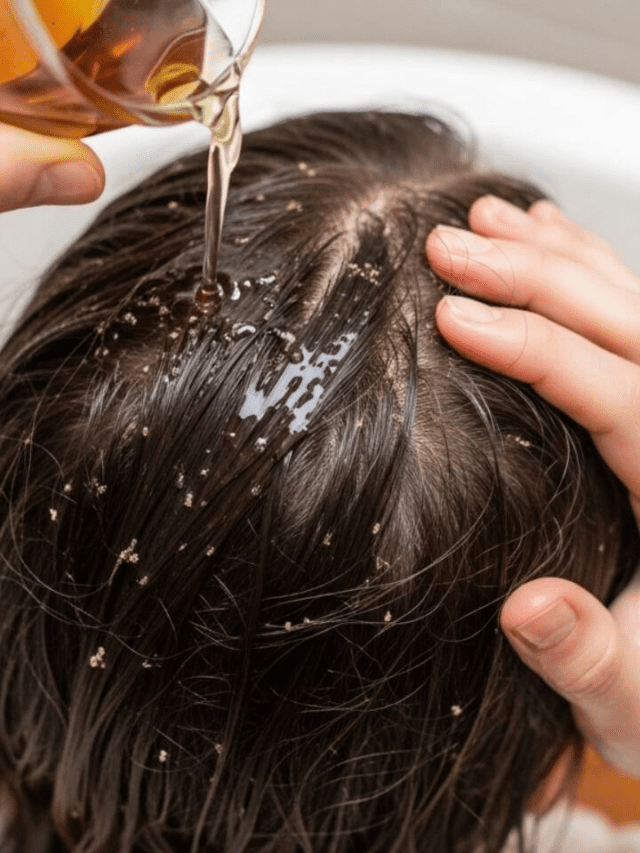 No More Lice: 7 Easy Home Tricks That Actually Work