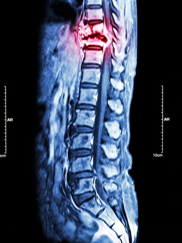 Prostate cancer and bone metastasis: Key facts and warning signs3 hours ago