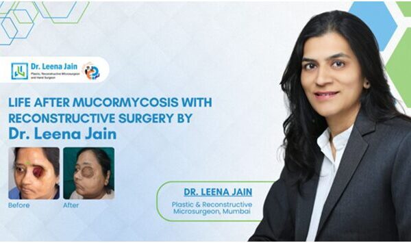 A post-COVID Mucormycosis Survivor gets a New Lease on Life after Dr Leena Jain successfully performs an Advanced Facial Reconstruction in Mumbai